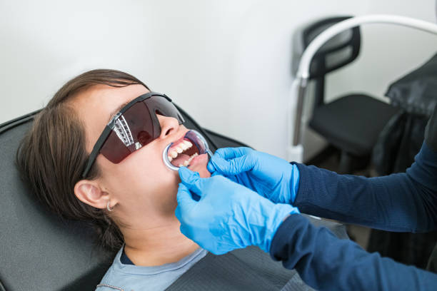 Best Knocked-Out Tooth (Avulsed Tooth) Treatment in Bel Air, MD